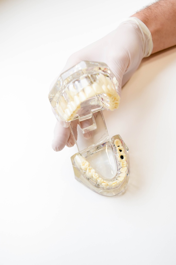 MODELO DENTAL TRANSPARENTE DE IMPLANTE CON NERVIO