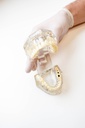 MODELO DENTAL TRANSPARENTE DE IMPLANTE CON NERVIO