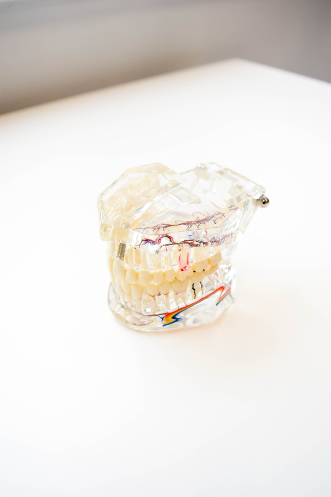 MODELO DENTAL TRANSPARENTE DE IMPLANTE CON NERVIOº