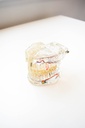 MODELO DENTAL TRANSPARENTE DE IMPLANTE CON NERVIOº