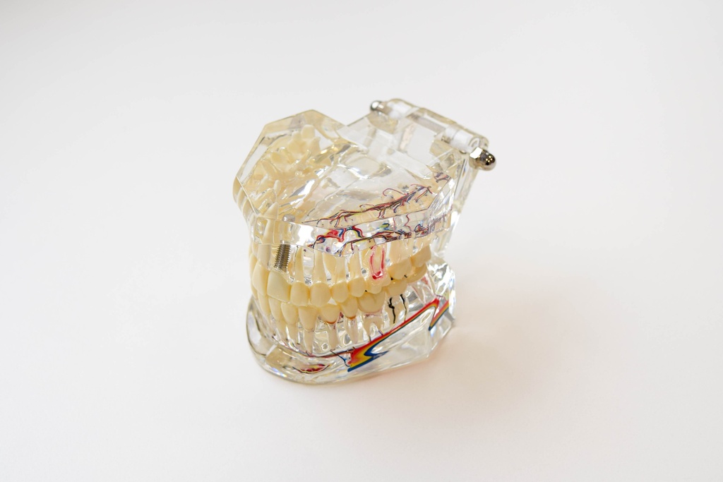 MODELO DENTAL TRANSPARENTE DE IMPLANTE CON NERVIO
