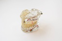MODELO DENTAL TRANSPARENTE DE IMPLANTE CON NERVIO