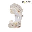 MODELO DENTAL DE IMPLANTE CON NERVIO