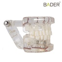 MODELO DENTAL DE IMPLANTE CON NERVIO