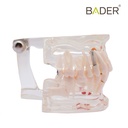 MODELO DENTAL TRANSPARENTE IMPLANTE