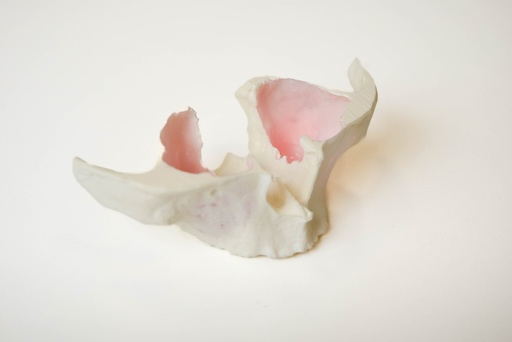 [0905141] MODELO DE ELEVACIÓN DE SENO